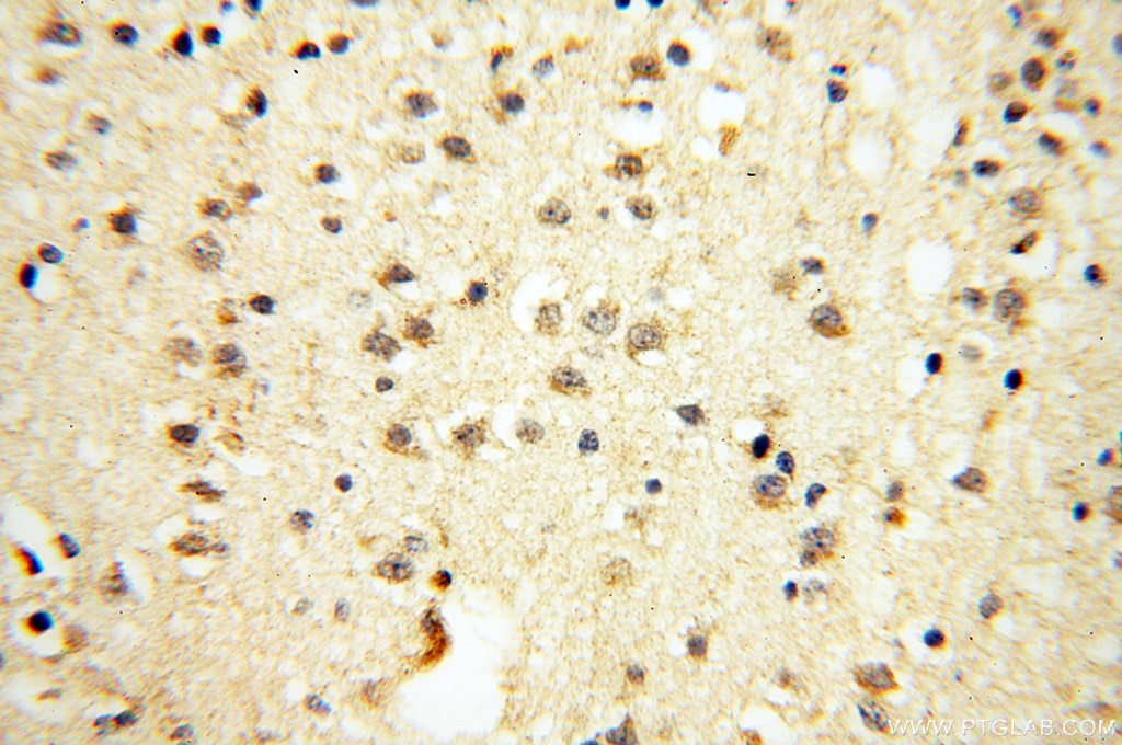 IHC staining of human brain using 12195-1-AP