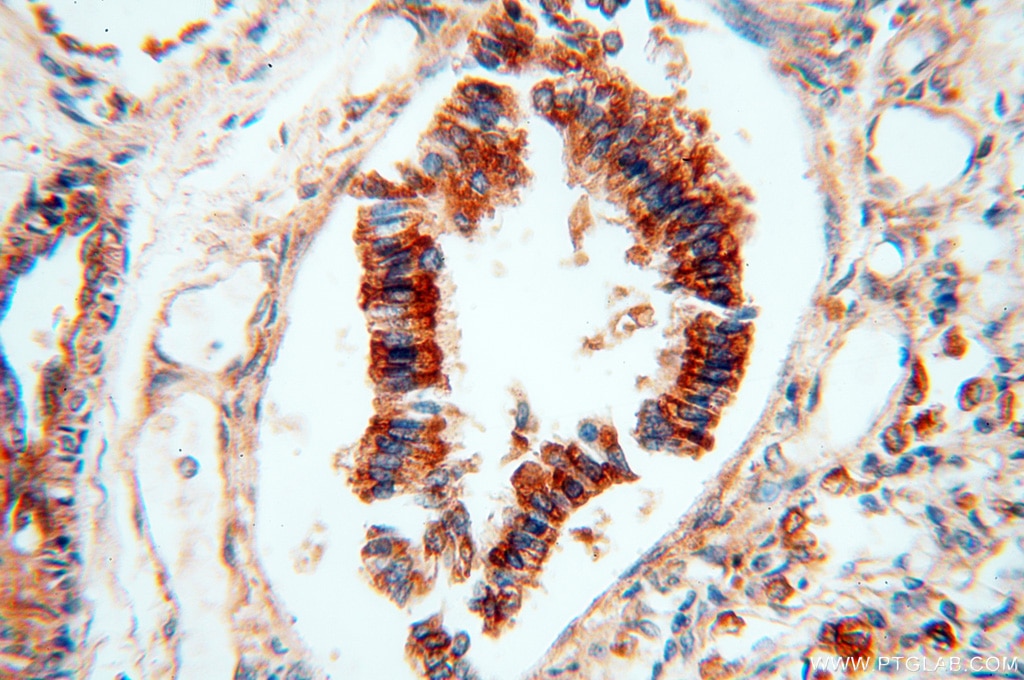 Immunohistochemistry (IHC) staining of human lung tissue using VPS33B Polyclonal antibody (12195-1-AP)
