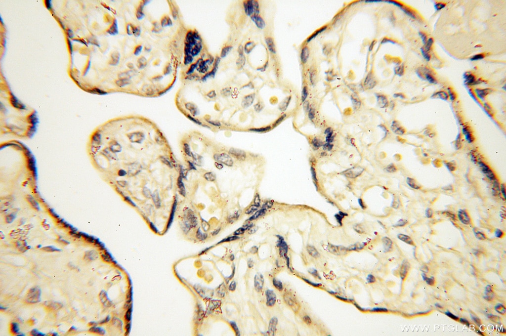 Immunohistochemistry (IHC) staining of human placenta tissue using VPS33B Polyclonal antibody (12195-1-AP)