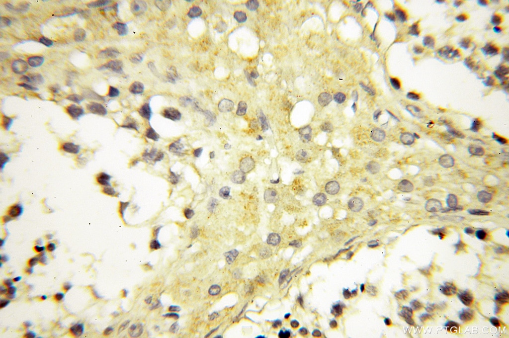 Immunohistochemistry (IHC) staining of human testis tissue using VPS33B Polyclonal antibody (12195-1-AP)