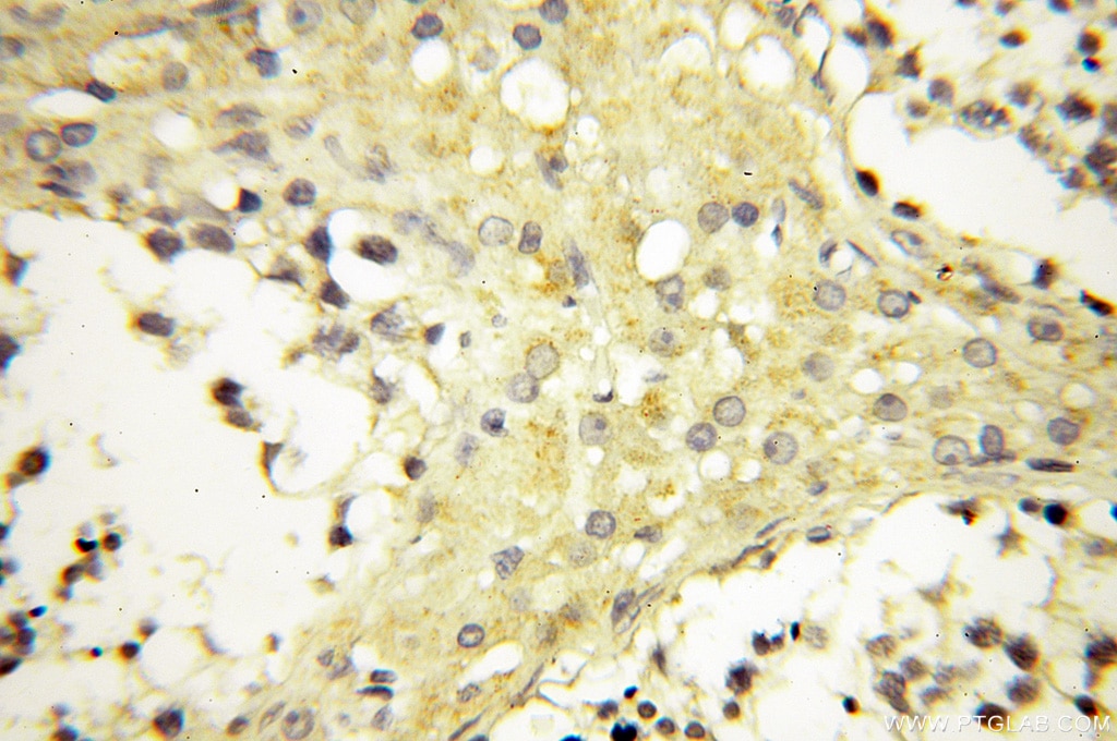 IHC staining of human testis using 12195-1-AP