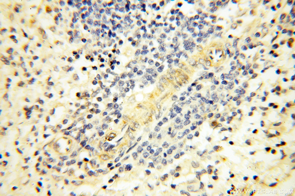 Immunohistochemistry (IHC) staining of human spleen tissue using VPS33B Polyclonal antibody (12195-1-AP)