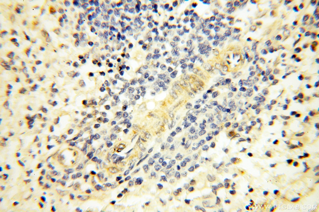 IHC staining of human spleen using 12195-1-AP