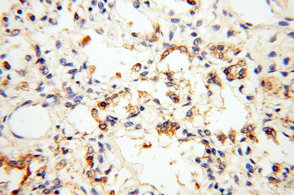 Immunohistochemistry (IHC) staining of human lung tissue using VPS33B Polyclonal antibody (12195-1-AP)