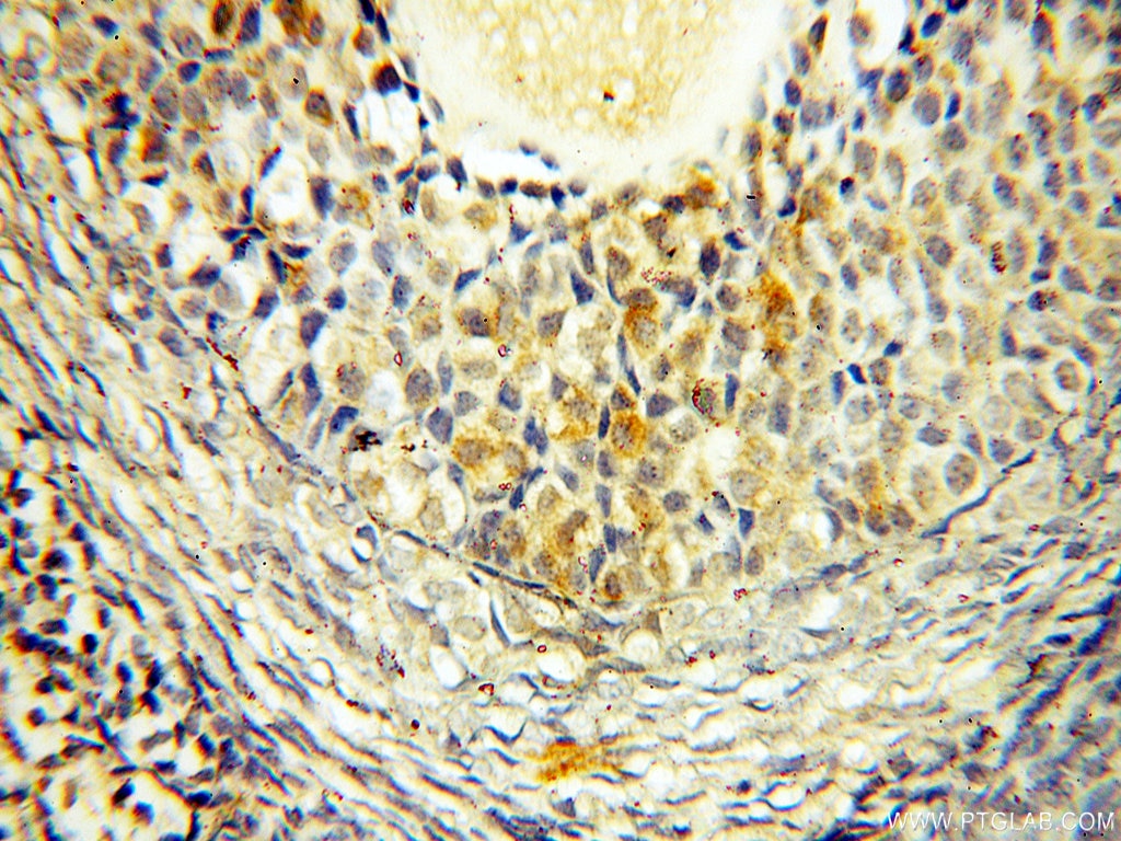 Immunohistochemistry (IHC) staining of human ovary tissue using VPS33B Polyclonal antibody (12195-1-AP)