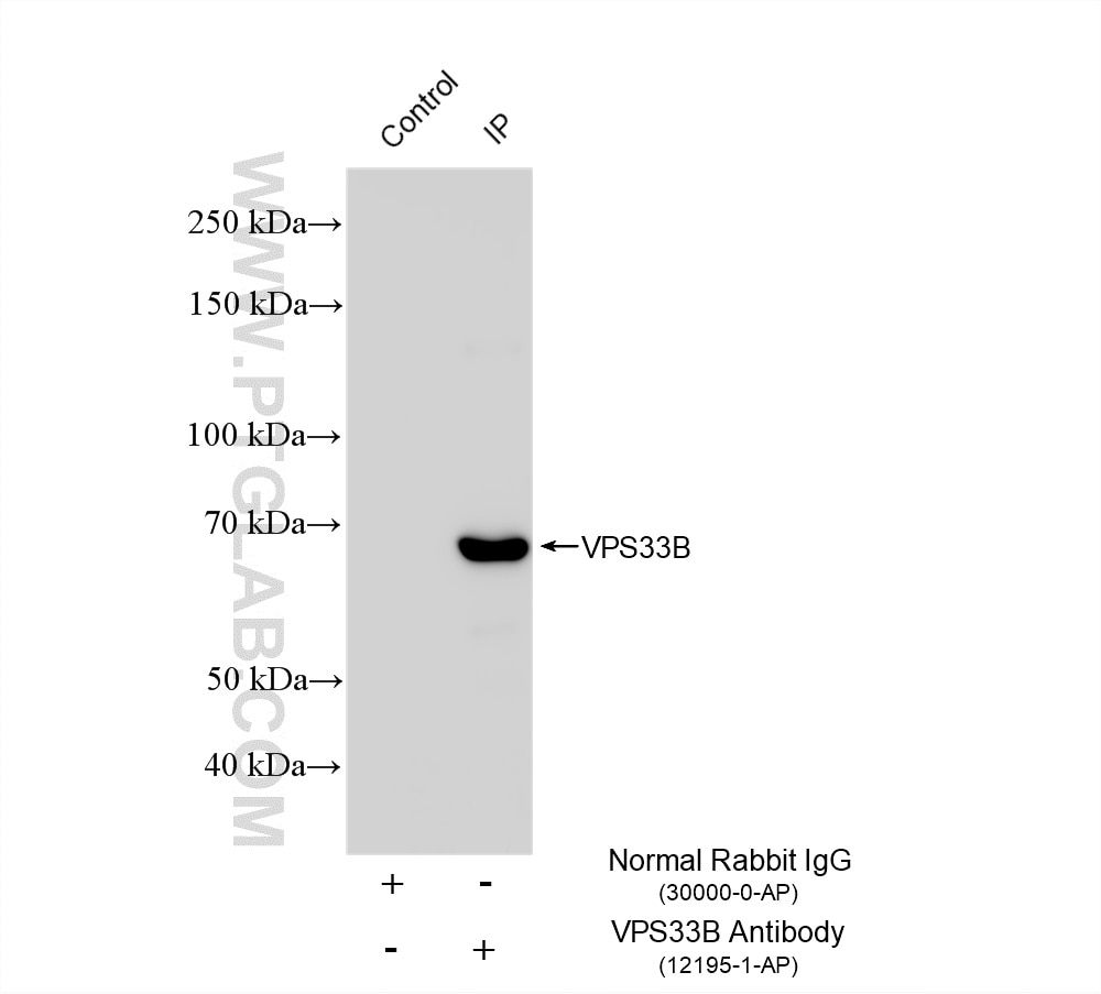 Immunoprecipitation (IP) experiment of HEK-293 cells using VPS33B Polyclonal antibody (12195-1-AP)