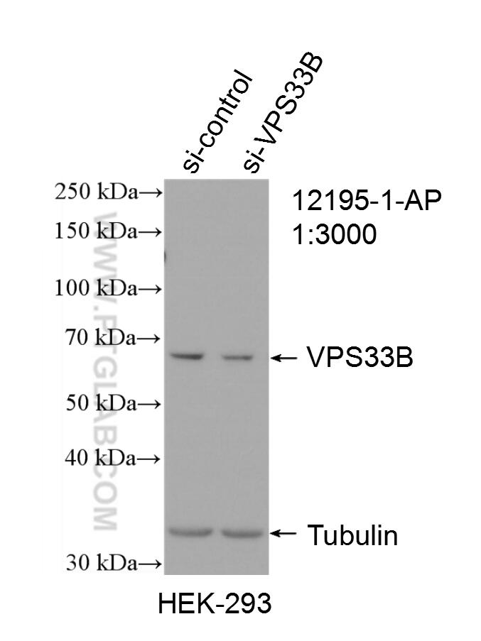 Western Blot (WB) analysis of HEK-293 cells using VPS33B Polyclonal antibody (12195-1-AP)