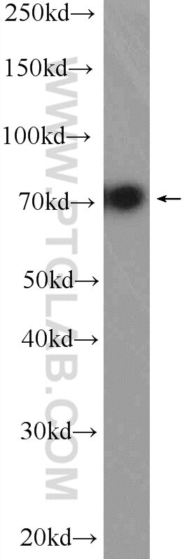 Western Blot (WB) analysis of HEK-293 cells using VPS33B Polyclonal antibody (12195-1-AP)