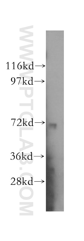 Western Blot (WB) analysis of mouse skeletal muscle tissue using VPS33B Polyclonal antibody (12195-1-AP)