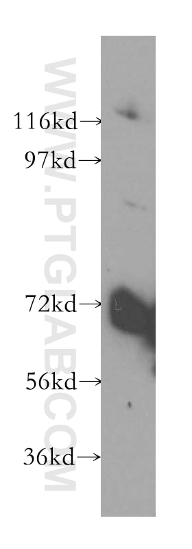 Western Blot (WB) analysis of HeLa cells using VPS33B Polyclonal antibody (12195-1-AP)