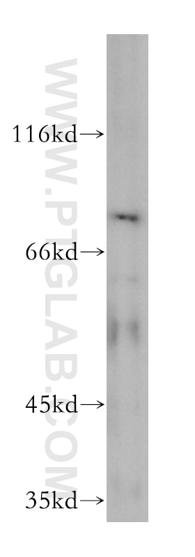 Western Blot (WB) analysis of mouse testis tissue using VPS33B Polyclonal antibody (12195-1-AP)