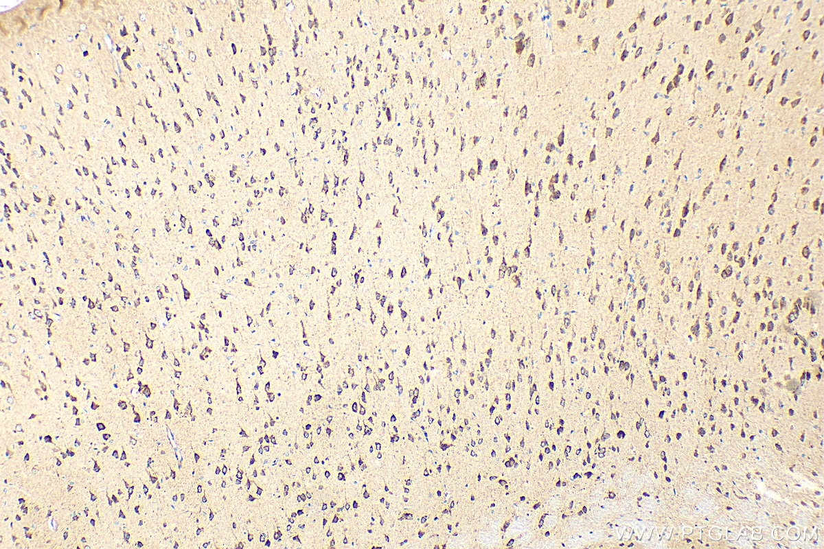 Immunohistochemistry (IHC) staining of mouse brain tissue using VPS33B Polyclonal antibody (28653-1-AP)