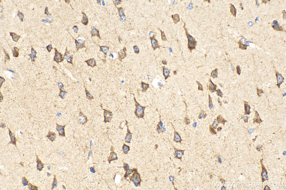 Immunohistochemistry (IHC) staining of mouse brain tissue using VPS33B Polyclonal antibody (28653-1-AP)