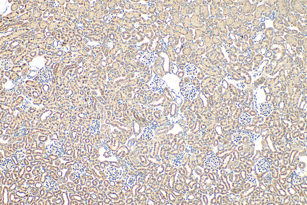 Immunohistochemistry (IHC) staining of mouse kidney tissue using VPS33B Polyclonal antibody (28653-1-AP)