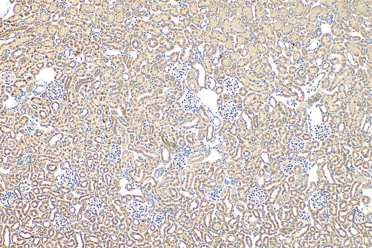 Immunohistochemistry (IHC) staining of mouse kidney tissue using VPS33B Polyclonal antibody (28653-1-AP)