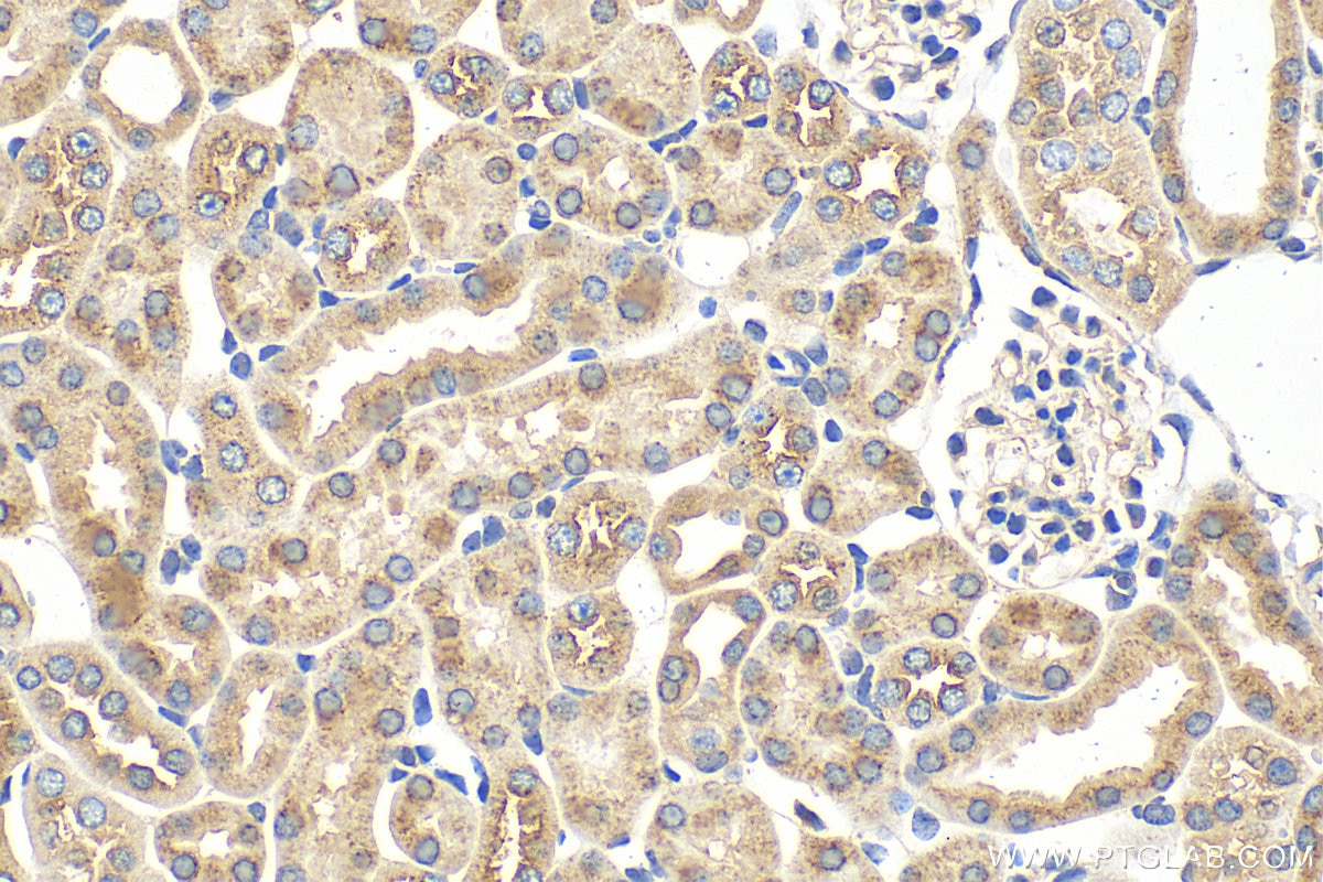 Immunohistochemistry (IHC) staining of mouse kidney tissue using VPS33B Polyclonal antibody (28653-1-AP)