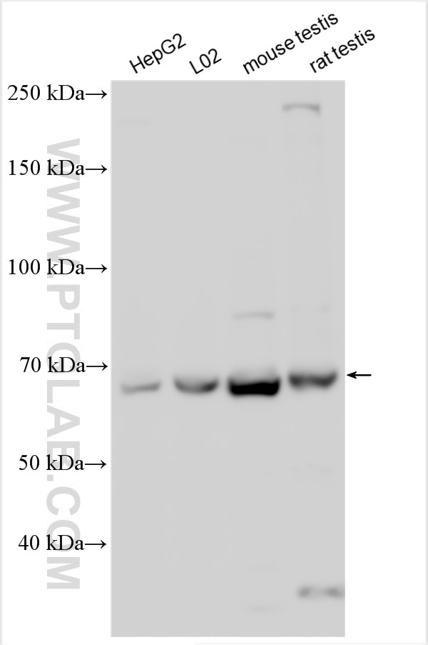 Western Blot (WB) analysis of various lysates using VPS33B Polyclonal antibody (28653-1-AP)