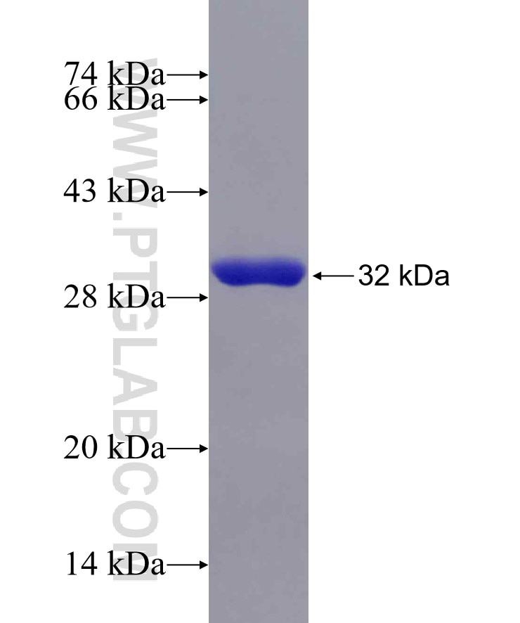 VPS33B fusion protein Ag29886 SDS-PAGE
