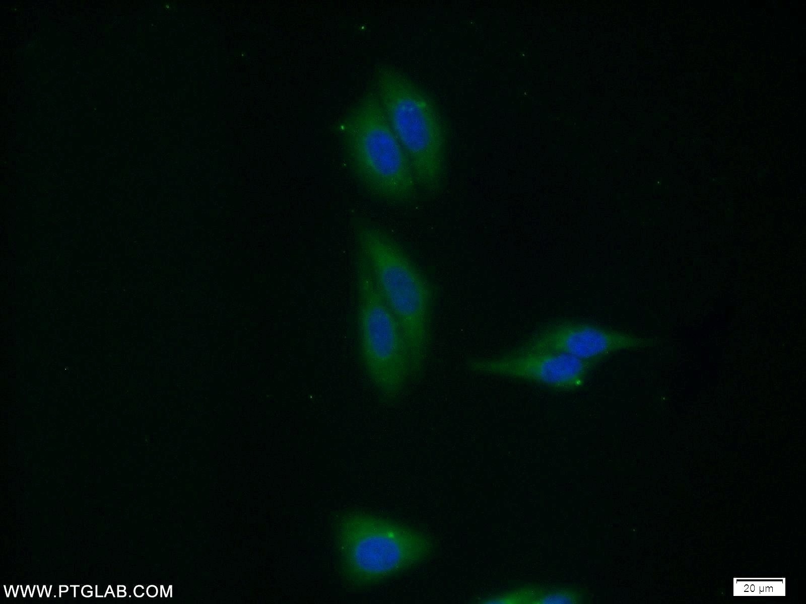 Immunofluorescence (IF) / fluorescent staining of HepG2 cells using VPS35 Polyclonal antibody (10236-1-AP)