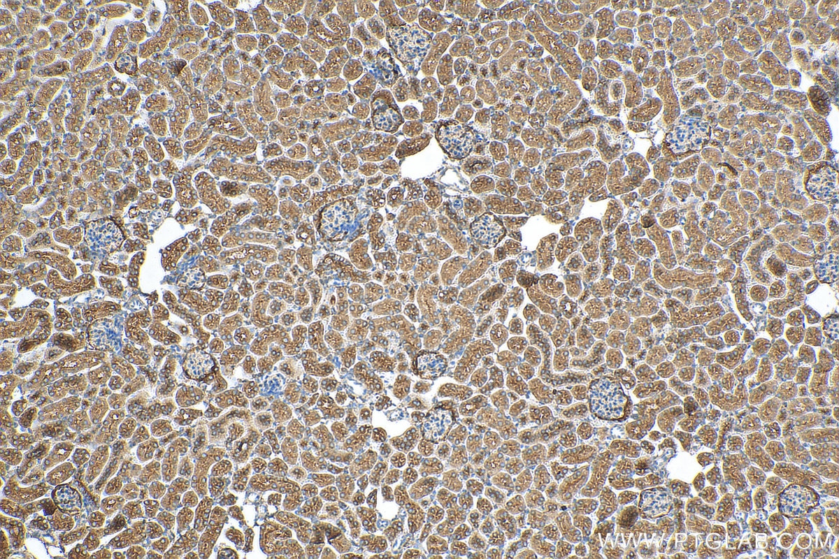 Immunohistochemistry (IHC) staining of mouse kidney tissue using VPS35 Polyclonal antibody (10236-1-AP)
