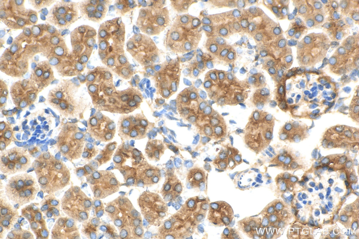 Immunohistochemistry (IHC) staining of mouse kidney tissue using VPS35 Polyclonal antibody (10236-1-AP)