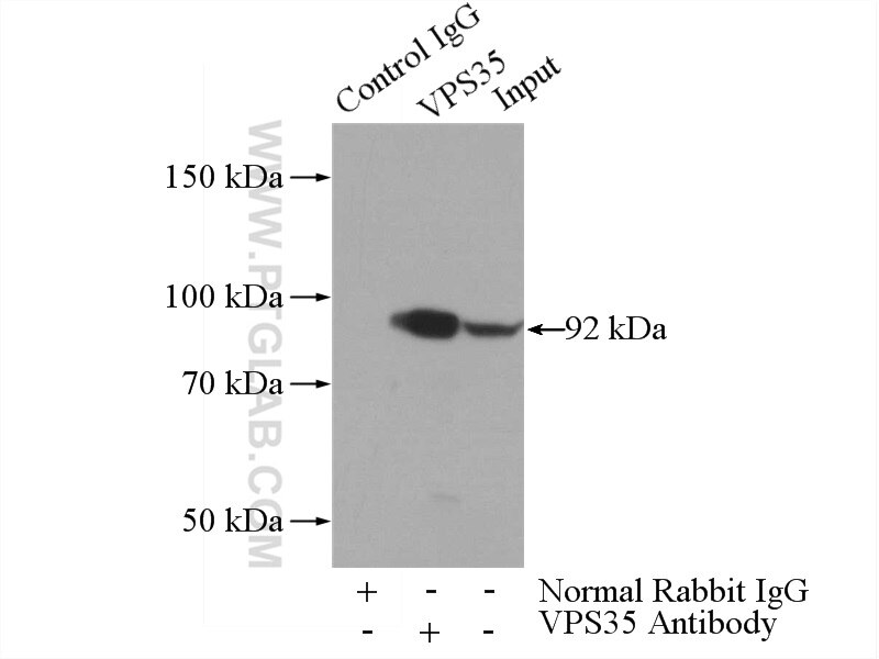 Immunoprecipitation (IP) experiment of mouse kidney tissue using VPS35 Polyclonal antibody (10236-1-AP)