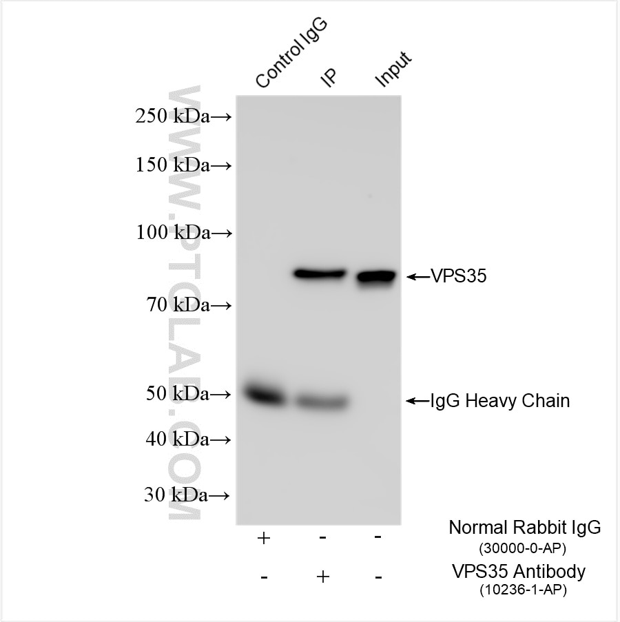 Immunoprecipitation (IP) experiment of HEK-293 cells using VPS35 Polyclonal antibody (10236-1-AP)