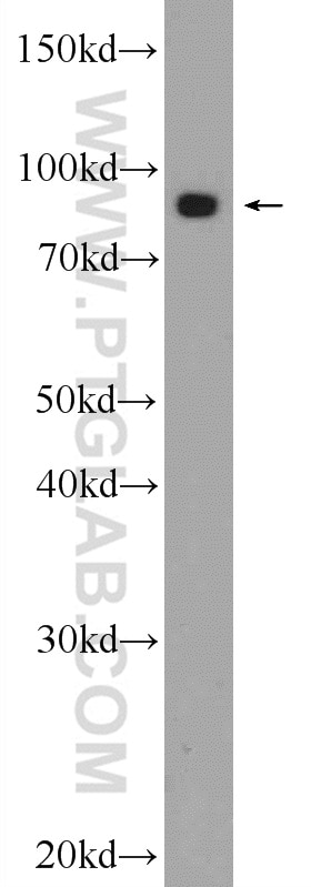 VPS35 Polyclonal antibody