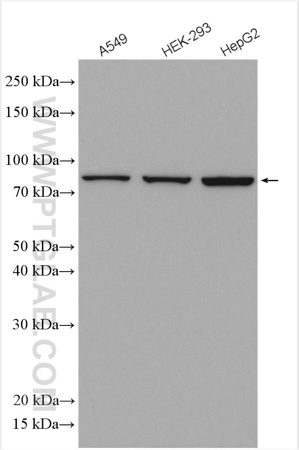Western Blot (WB) analysis of various lysates using VPS35 Polyclonal antibody (10236-1-AP)