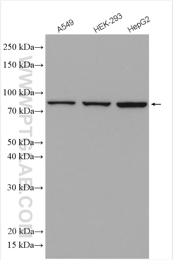 Western Blot (WB) analysis of various lysates using VPS35 Polyclonal antibody (10236-1-AP)