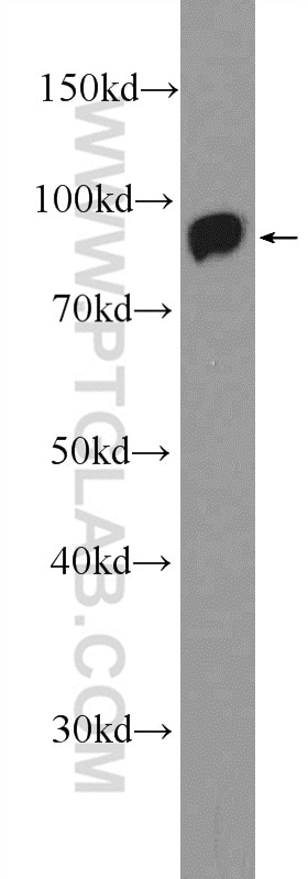 Western Blot (WB) analysis of rat liver tissue using VPS35 Polyclonal antibody (10236-1-AP)