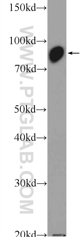 Western Blot (WB) analysis of rat kidney tissue using VPS35 Polyclonal antibody (10236-1-AP)