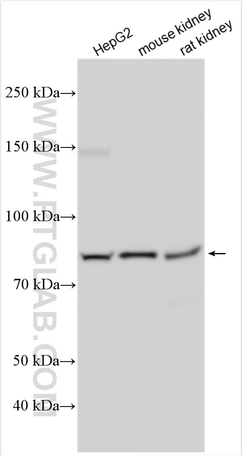 Western Blot (WB) analysis of various lysates using VPS35 Polyclonal antibody (10236-1-AP)