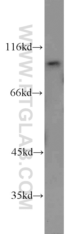 Western Blot (WB) analysis of mouse brain tissue using VPS35 Polyclonal antibody (10236-1-AP)