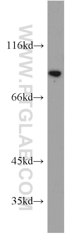 Western Blot (WB) analysis of mouse kidney tissue using VPS35 Polyclonal antibody (10236-1-AP)