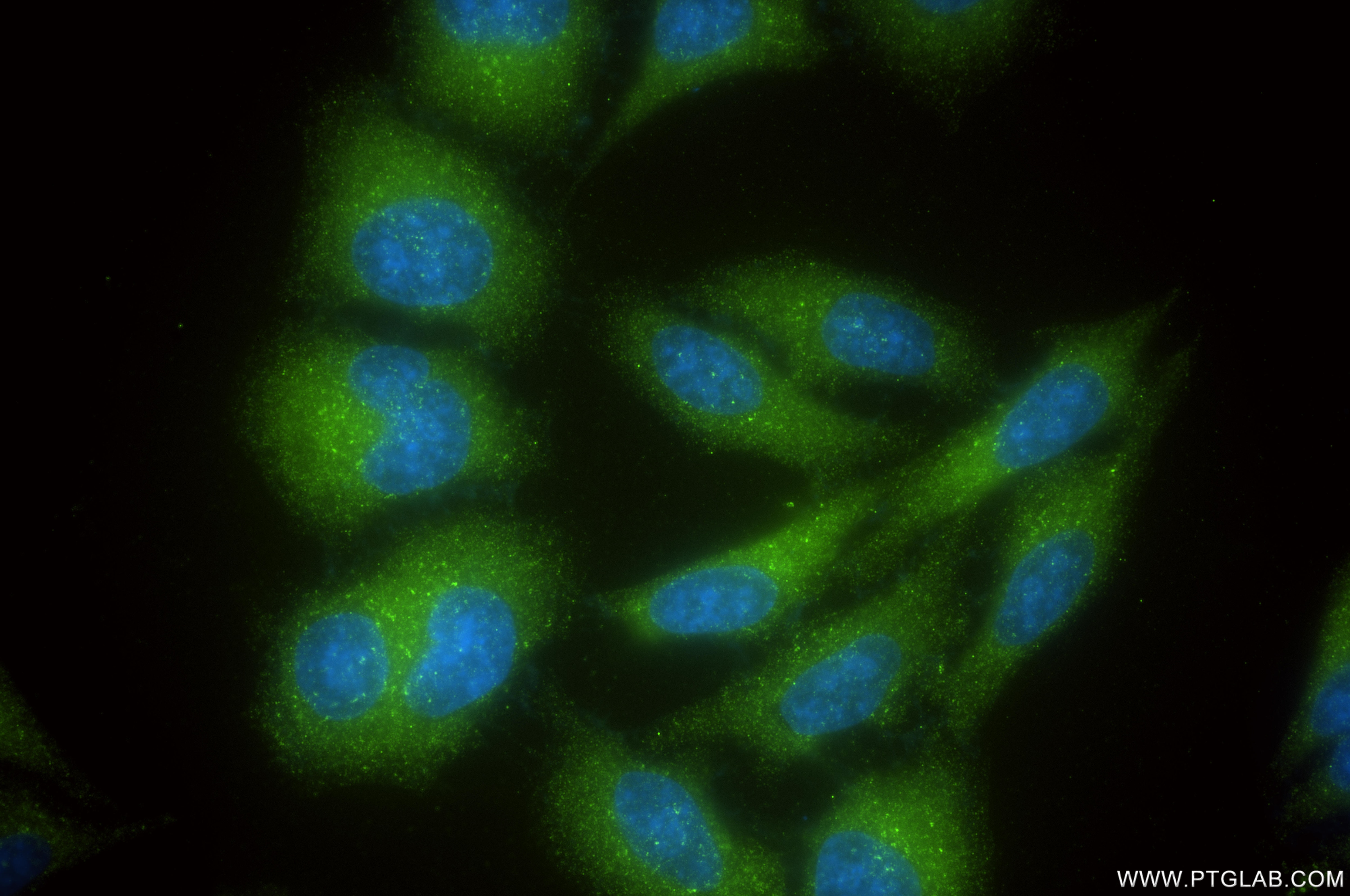 Immunofluorescent analysis of (-20°C Ethanol) fixed HepG2 cells using VPS35 antibody (83328-2-RR, Clone: 250521F1 ) at dilution of 1:200 and CoraLite®488-Conjugated Goat Anti-Rabbit IgG(H+L) (SA00013-2). Immunofluorescence (IF) / fluorescent staining of HepG2 cells using VPS35 Recombinant monoclonal antibody (83328-2-RR)