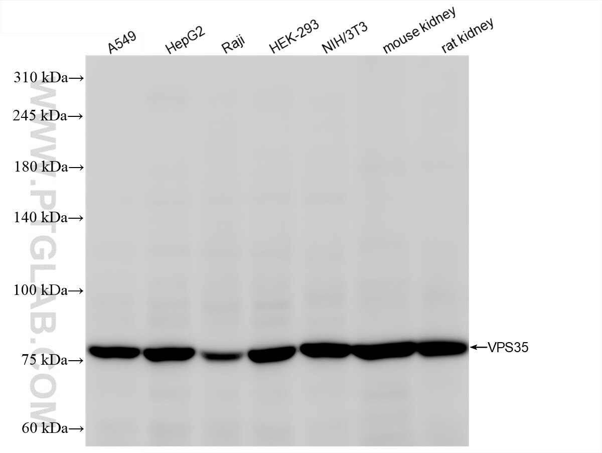 VPS35