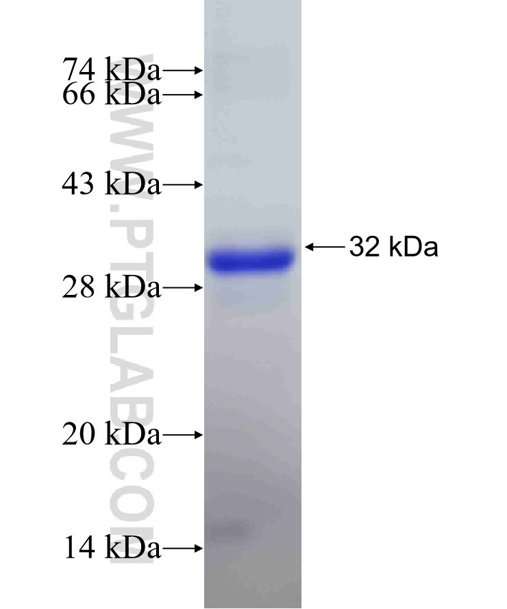 VPS35 fusion protein Ag22879 SDS-PAGE
