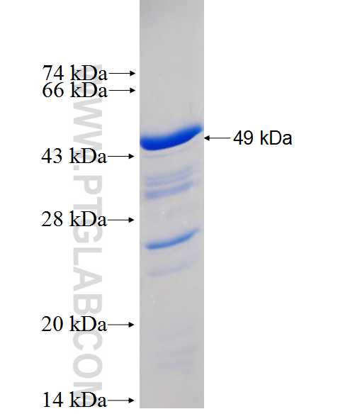 VPS35 fusion protein Ag0340 SDS-PAGE