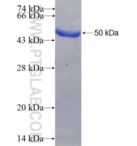 VPS36 fusion protein Ag5549 SDS-PAGE