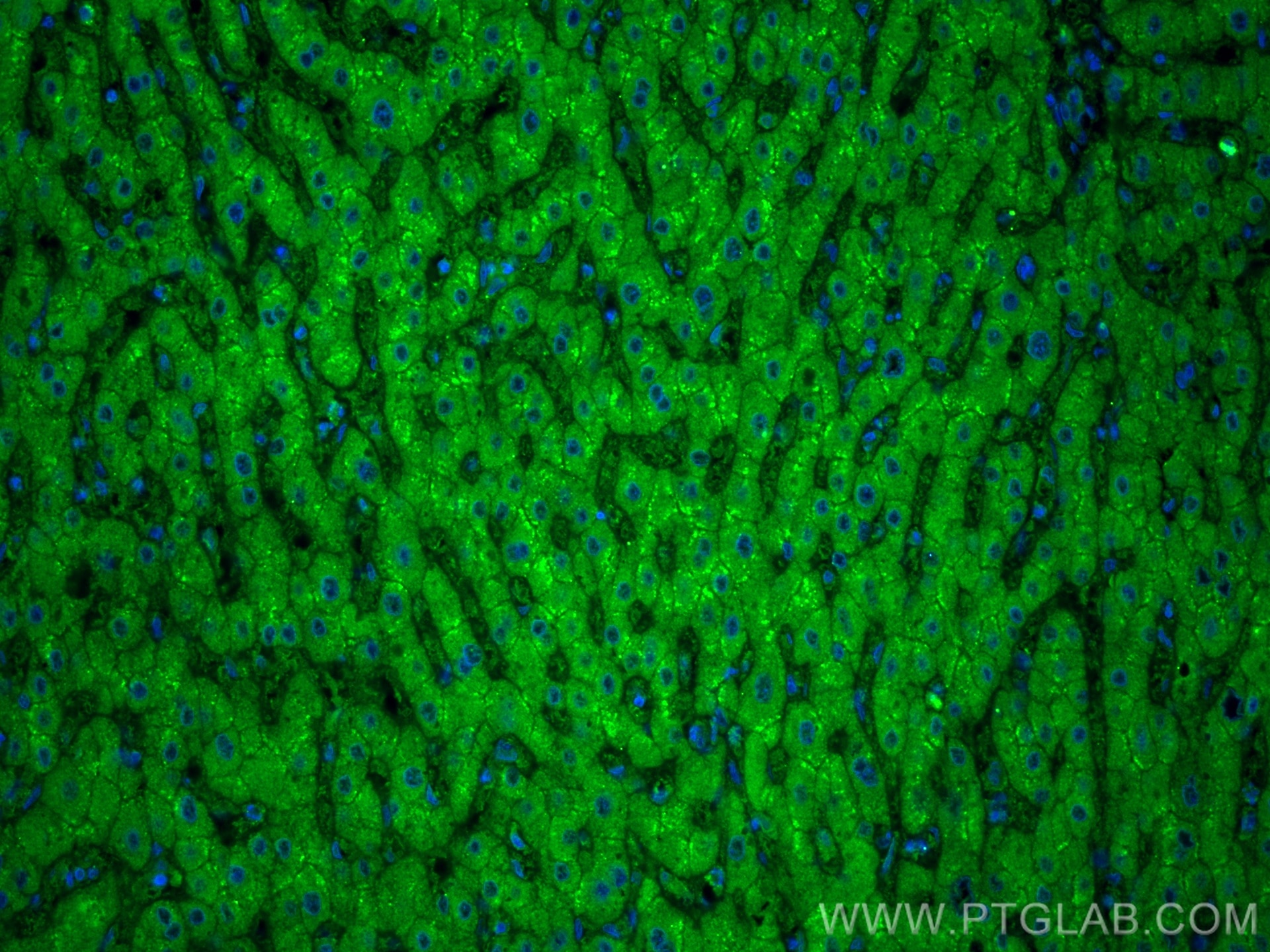 Immunofluorescence (IF) / fluorescent staining of human liver tissue using VPS37A Polyclonal antibody (11870-1-AP)