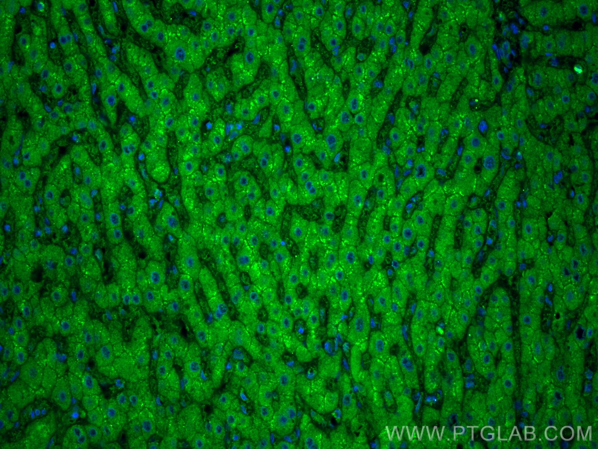 Immunofluorescence (IF) / fluorescent staining of human liver tissue using VPS37A Polyclonal antibody (11870-1-AP)