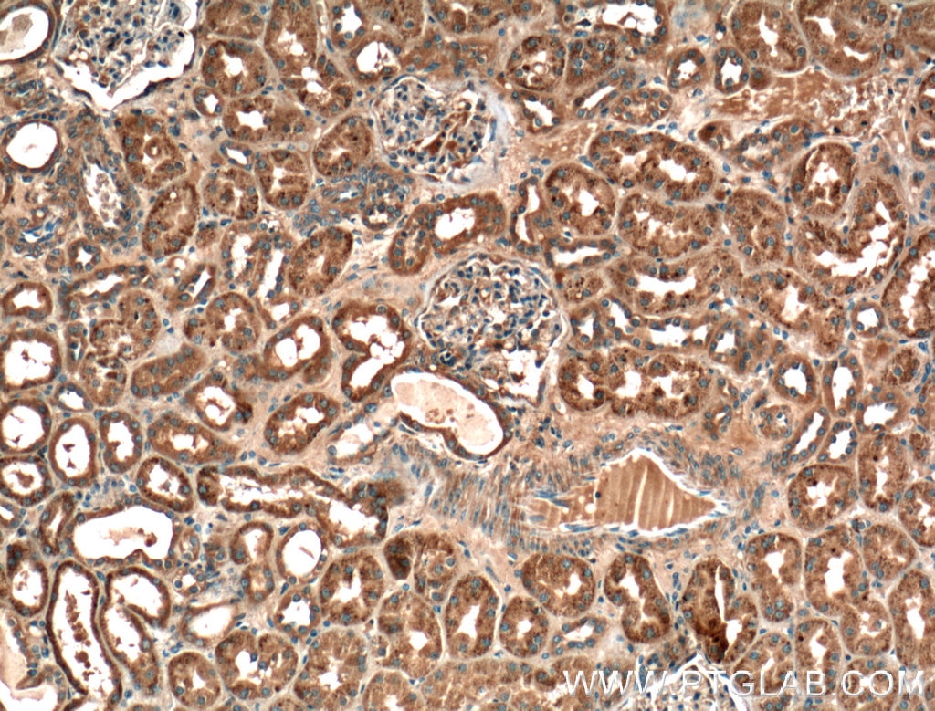 IHC staining of human kidney using 11870-1-AP