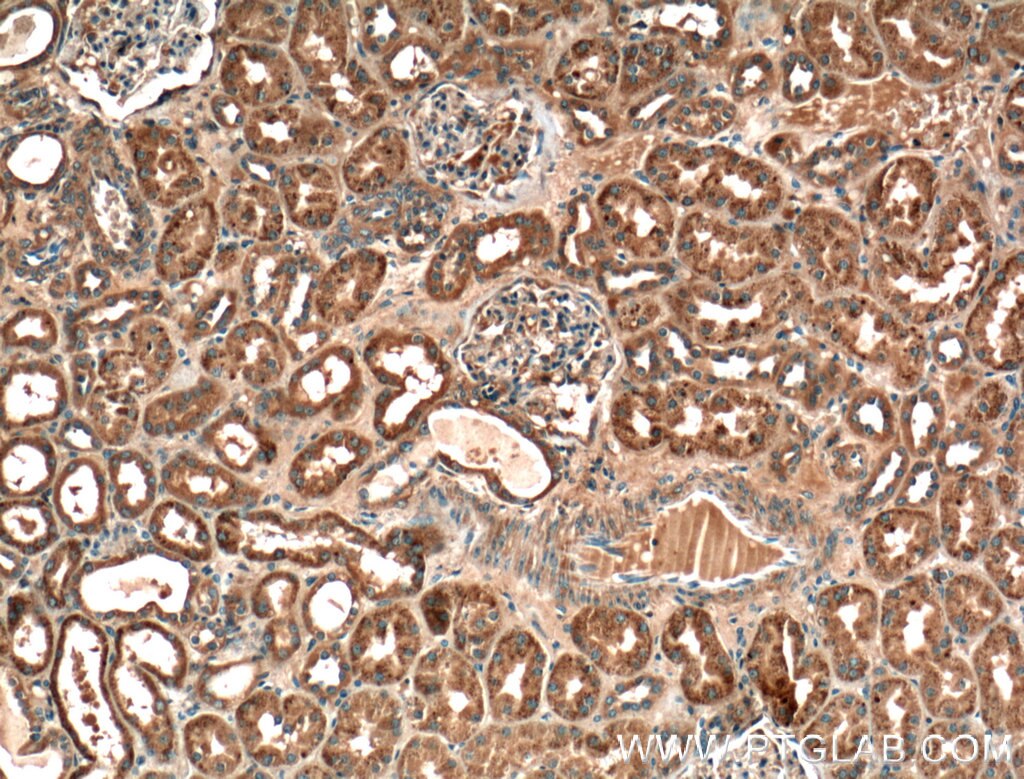 IHC staining of human kidney using 11870-1-AP