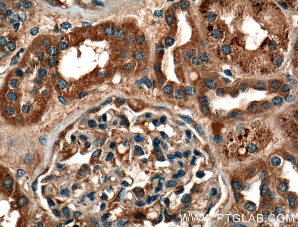 Immunohistochemistry (IHC) staining of human kidney tissue using VPS37A Polyclonal antibody (11870-1-AP)