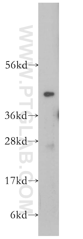 Western Blot (WB) analysis of human liver tissue using VPS37A Polyclonal antibody (11870-1-AP)
