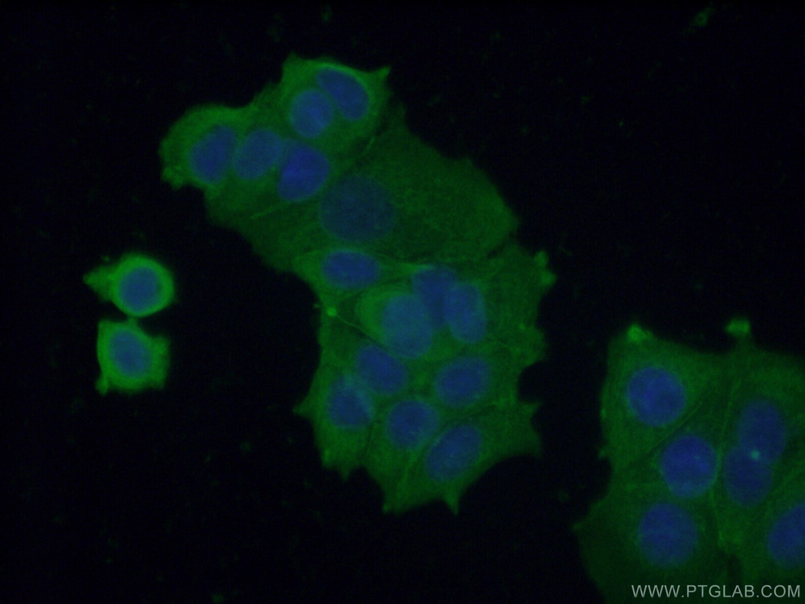 Immunofluorescence (IF) / fluorescent staining of MCF-7 cells using VPS37A Monoclonal antibody (66327-1-Ig)