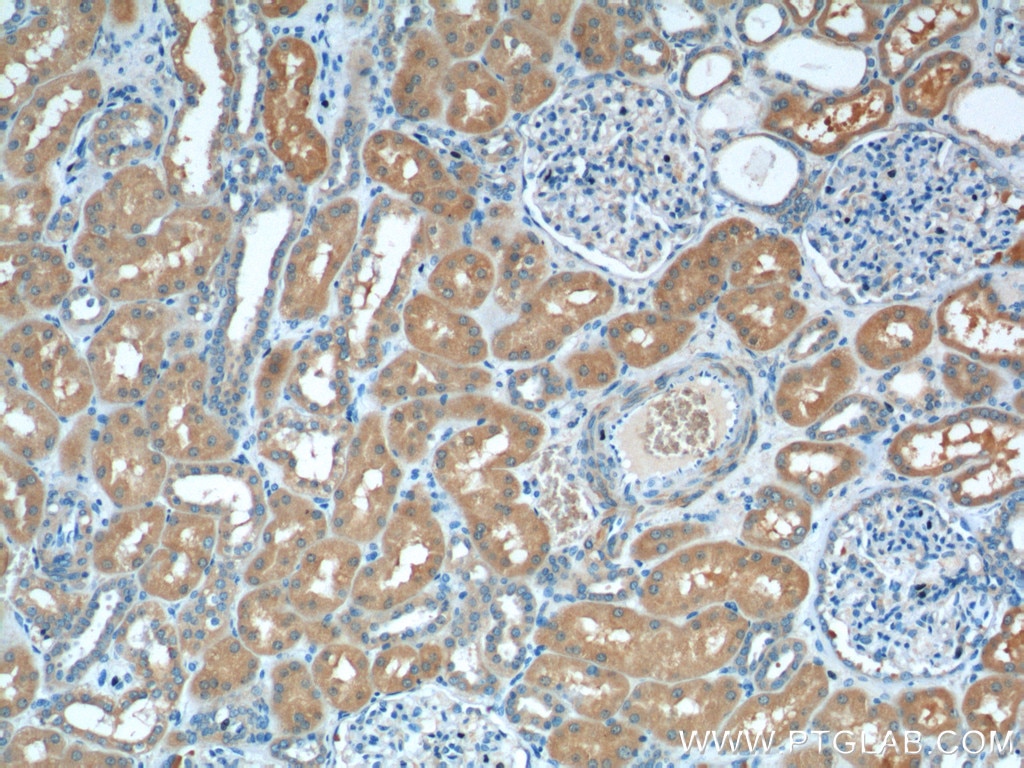 IHC staining of human kidney using 66327-1-Ig