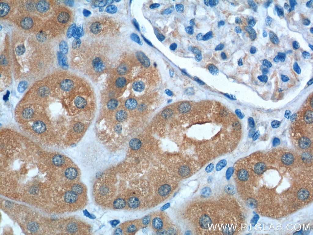 Immunohistochemistry (IHC) staining of human kidney tissue using VPS37A Monoclonal antibody (66327-1-Ig)