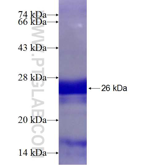 VPS37A fusion protein Ag19108 SDS-PAGE